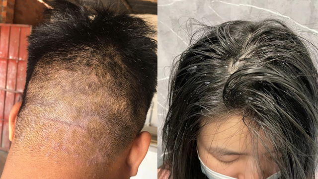 Trải nghiệm thật sau 10 ngày gội Antisol: Da đầu đỡ ngứa - tóc nhẹ thoáng hơn hẳn?- Ảnh 2.