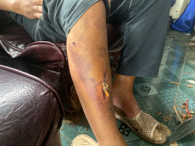 Huế: Nhóm thiếu niên nhiều lần hành hung vô cớ người đàn ông - Ảnh 1.