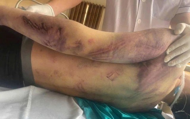 Vụ nam sinh 17 tuổi tử vong: Trung tâm xã hội ở Quảng Ninh bị tạm đình chỉ hoạt động- Ảnh 1.