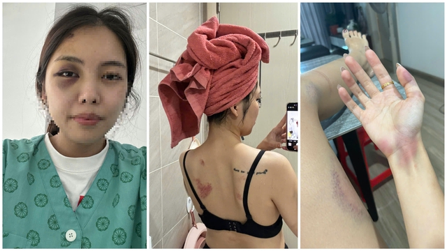 Hà Nội: Sẽ khởi tố người đàn ông đánh đập, kéo lê vợ ở hành lang chung cư- Ảnh 1.