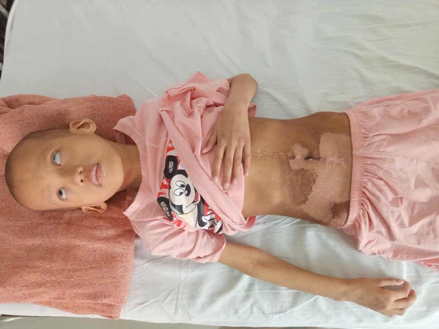 Ánh mắt cầu cứu của bé gái 7 tuổi bị mù lòa, mắc bệnh hiểm nghèo- Ảnh 4.