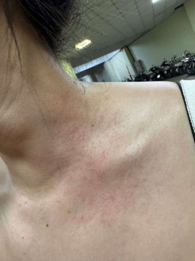 Cư dân 6 tòa chung cư ở Hà Nội phản ánh nước vàng, đục: “Bỏ tiền mua nước sạch sao phải dùng nước bẩn”- Ảnh 1.