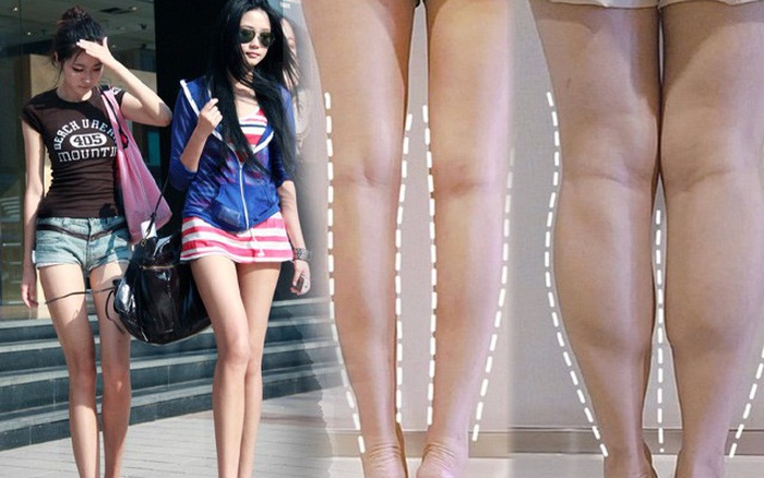 Các cô gái Trung Quốc chọn cách mạo hiểm để có đôi chân thon gọn.