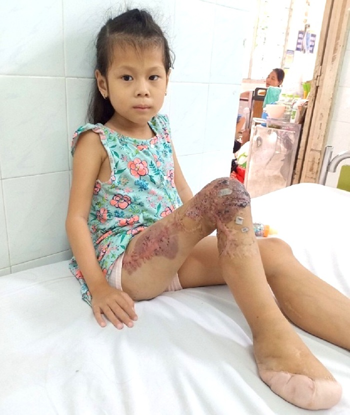 Bé gái 8 tuổi trải qua 19 lần phẫu thuật khi mắc căn bệnh quái ác  - Ảnh 1.