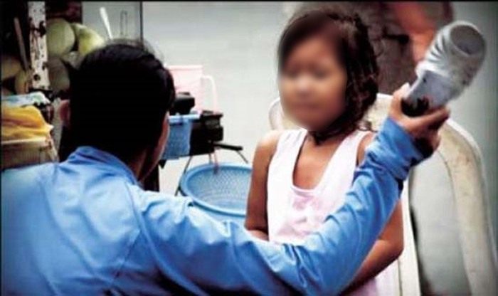Cục Trẻ em đề nghị Công an thị xã Nghi Sơn điều tra, xử lý nghiêm hành vi bạo hành trẻ em (ảnh minh họa)
