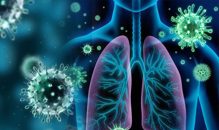 Viêm phế quản có chuyển thành viêm phổi không? - Ảnh 3.