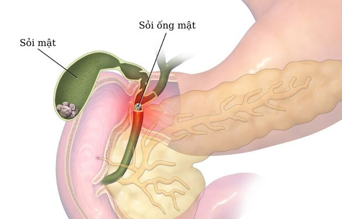 Những điều cần biết về phân nhạt màu - Ảnh 2.