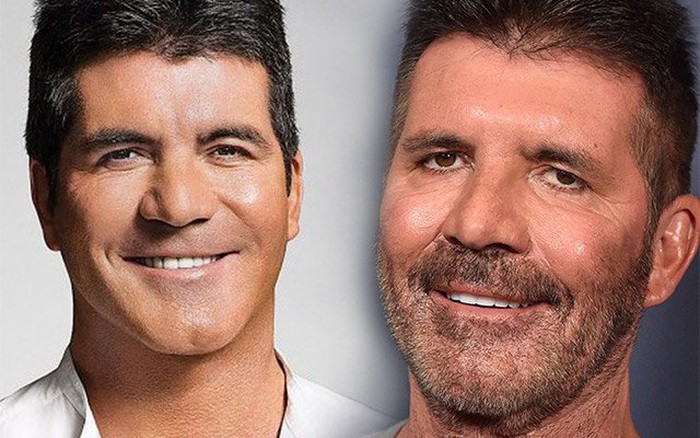Simon Cowell tiêm botox nhiều đến mức khiến con trai 8 tuổi "khóc thét"