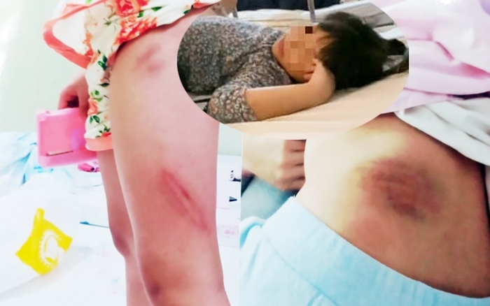 Vụ bố dượng bị tố bạo hành con riêng của vợ: Hội LHPN Việt Nam đề nghị giải quyết
