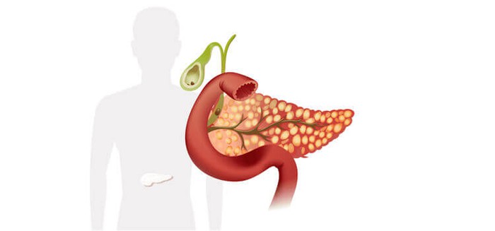 Bệnh sau Tết: Nhận biết triệu chứng viêm tuỵ cấp tránh nhầm lẫn với bệnh tiêu hoá - Ảnh 2.