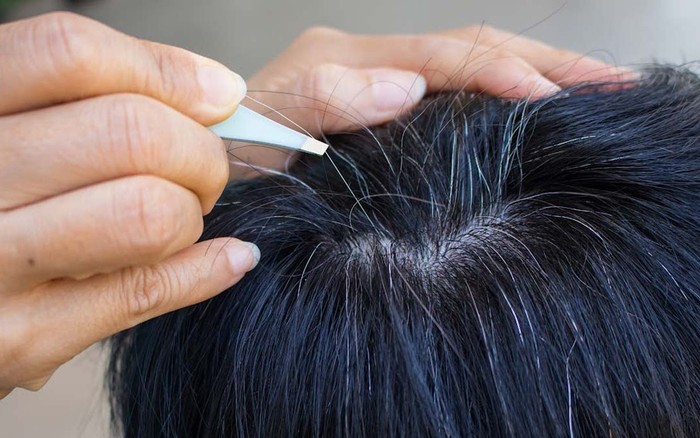 Bài thuốc Đông y chữa tóc bạc sớm có thể bạn chưa biết - Nhà thuốc FPT Long  Châu