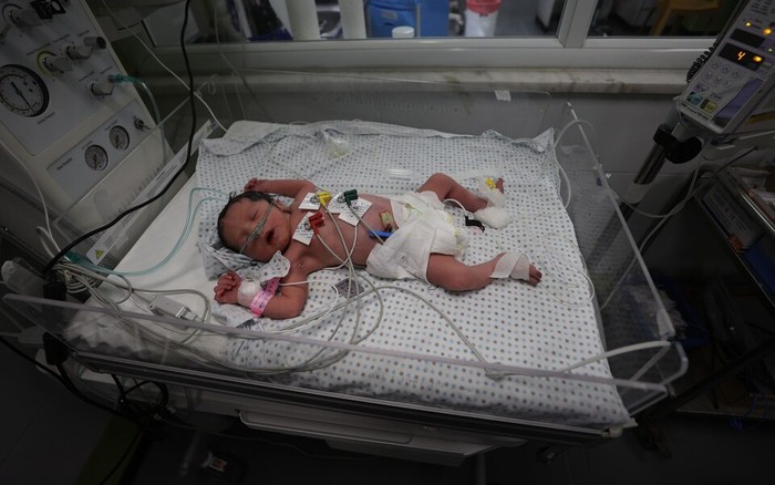 Sinh con trong bom đạn và thiếu thốn ở Gaza- Ảnh 2.