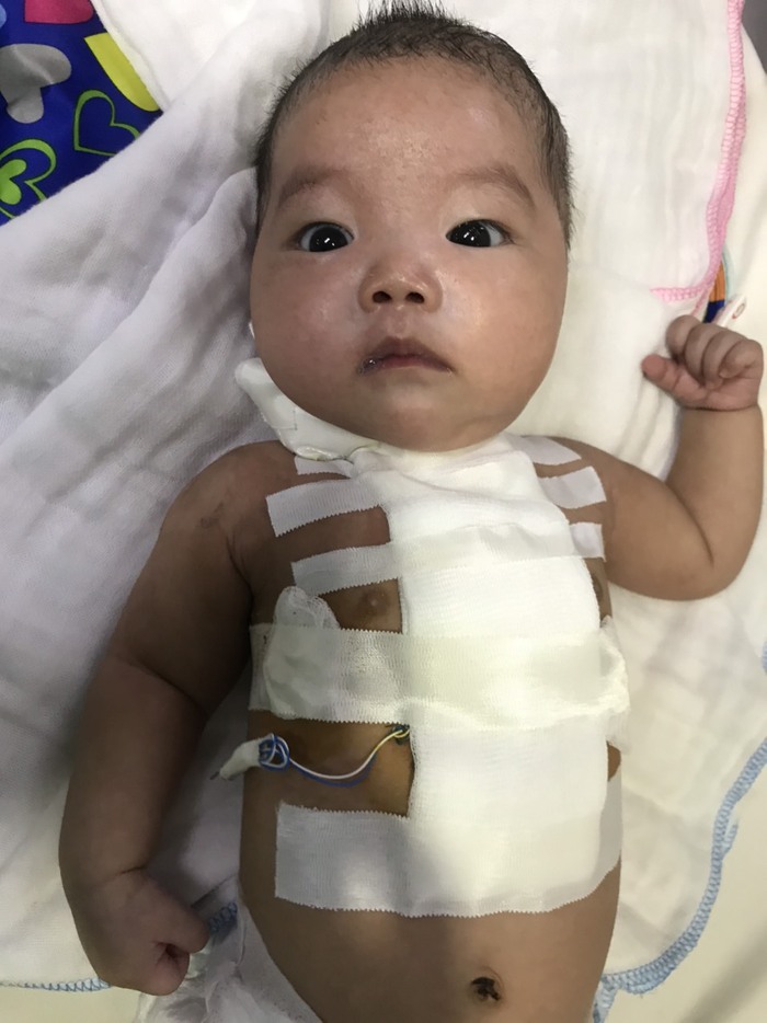 Chung tay cứu giúp bé trai 5 tháng tuổi mắc bệnh hiểm nghèo không tiền chữa trị - Ảnh 7.