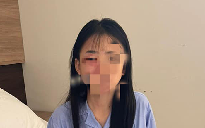 Hà Nội: Nữ sinh lớp 8 bị đánh hội đồng phải nhập viện