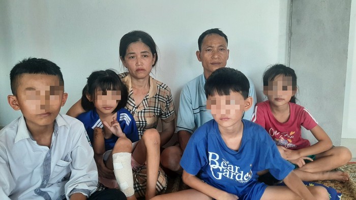 Sức khoẻ hiện tại của 3 cháu bé là nạn nhân trong vụ nổ kinh hoàng tại Nghệ An - Ảnh 7.