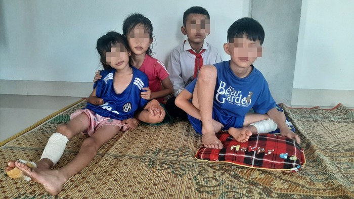 Sức khoẻ hiện tại của 3 cháu bé là nạn nhân trong vụ nổ kinh hoàng tại Nghệ An - Ảnh 6.