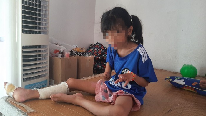 Sức khoẻ hiện tại của 3 cháu bé là nạn nhân trong vụ nổ kinh hoàng tại Nghệ An - Ảnh 3.