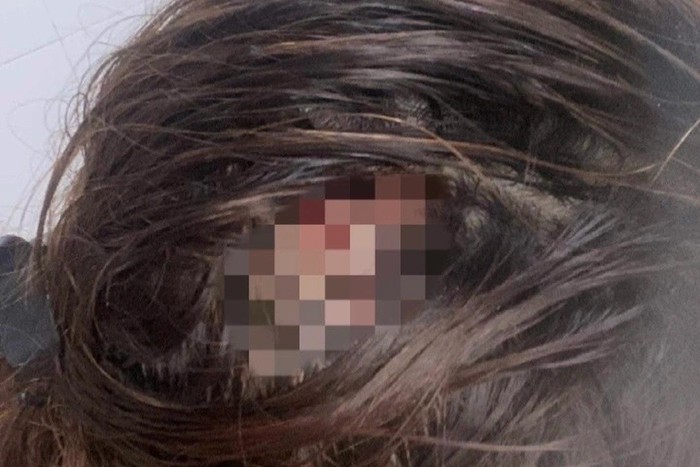 Bình Dương: Thiếu nữ 16 tuổi hai lần bị chủ cơ sở thẩm mỹ đánh đập, cắt tóc - Ảnh 2.