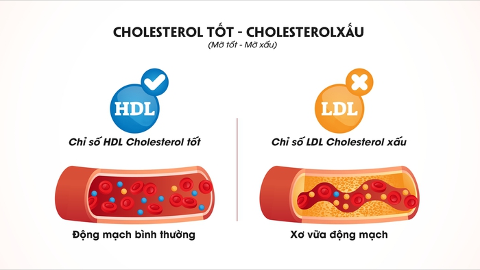 Cứ 10 người Việt trưởng thành thì có 3 người thừa cholesterol vì một nguyên nhân  - Ảnh 1.