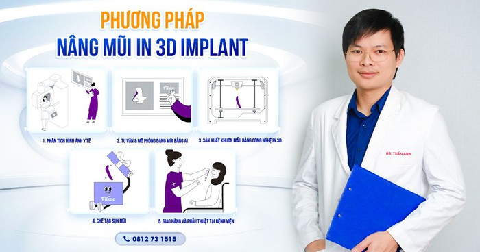 Bác sĩ Nguyễn Tuấn Anh cùng ứng dụng công nghệ Nâng Mũi In 3D Implant- Ảnh 1.