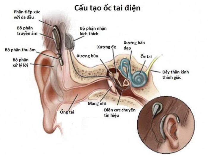 Đột phá: Trung Quốc thử nghiệm liệu pháp gen, chữa bệnh câm điếc bẩm sinh chỉ bằng một mũi tiêm- Ảnh 5.