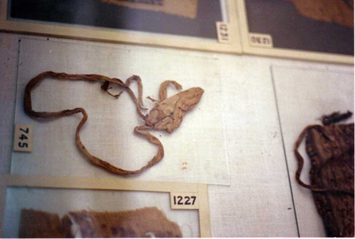 Đây là 5 công cụ tránh thai của 100 năm trước, giờ bạn sẽ chỉ còn thấy chúng trong viện bảo tàng- Ảnh 2.
