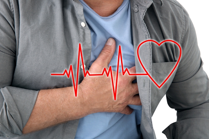 Những điều cần biết về hội chứng QT kéo dài, tình trạng có thể gây đột tử tim- Ảnh 1.