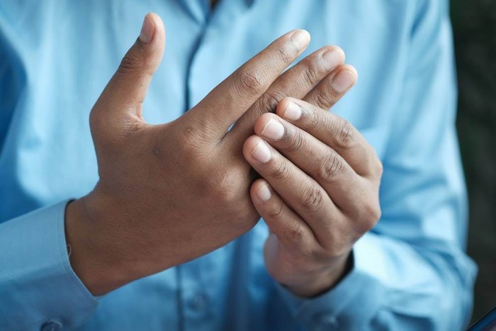 10 tình trạng ở bàn tay có thể là triệu chứng của bệnh tiềm ẩn- Ảnh 2.