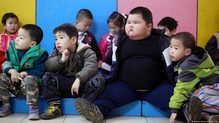 WHO: Thế giới chào đón công dân béo phì thứ 1 tỷ, con số tăng gấp 5 lần kể từ khi thế hệ 9x ra đời- Ảnh 4.