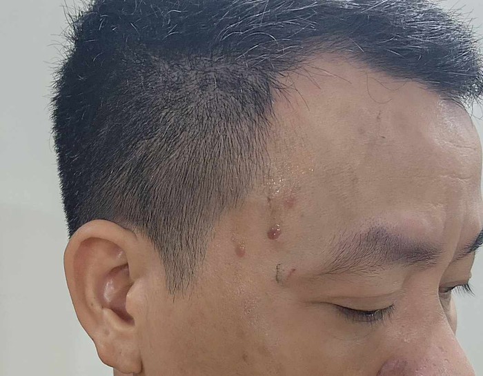 Hà Nội: Hai phóng viên bị hành hung khi đang tác nghiệp - Ảnh 1.
