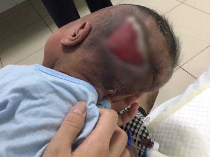 Ánh mắt cầu cứu của bé trai 5 tháng tuổi toàn thân lở loét vì căn bệnh quái ác- Ảnh 3. Ánh mắt cầu cứu của bé trai 5 tháng tuổi toàn thân lở loét vì căn bệnh quái ác- Ảnh 3.