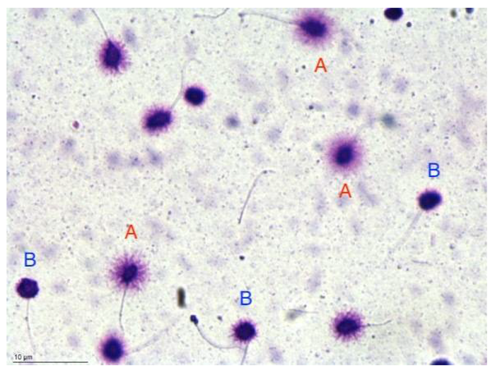 Người đàn ông bất ngờ phát hiện mắc ung thư ở miệng vì chủng virus anh nghĩ chỉ gây bệnh cho phụ nữ- Ảnh 8.