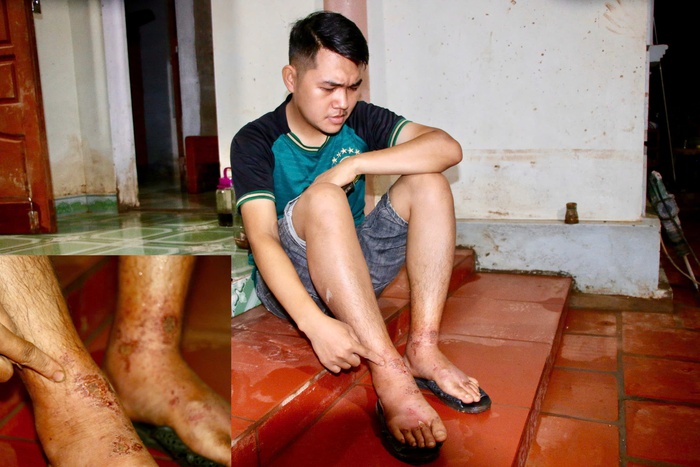 Vụ vỡ hồ chứa bùn ở Thái Nguyên: Tiến hành lấy mẫu, sẽ sớm có kết quả xét nghiệm hóa chất- Ảnh 2. Vụ vỡ hồ chứa bùn ở Thái Nguyên: Tiến hành lấy mẫu, sẽ sớm có kết quả xét nghiệm hóa chất- Ảnh 2.