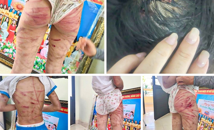 Bắt khẩn cấp cha dượng bạo hành bé gái lớp 5- Ảnh 1. Bắt khẩn cấp cha dượng bạo hành bé gái lớp 5- Ảnh 1.