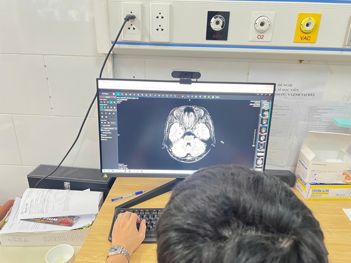 Thiếu niên 15 tuổi tổn thương não vì ngộ độc thuốc lá điện tử chứa chất độc thế hệ mới - Ảnh 2. Thiếu niên 15 tuổi tổn thương não vì ngộ độc thuốc lá điện tử chứa chất độc thế hệ mới - Ảnh 2.