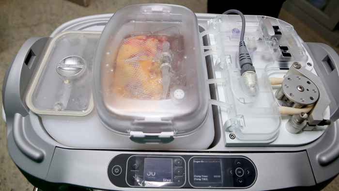 Ca ghép thận đầu tiên tại Việt Nam ứng dụng công nghệ đột phá trong bảo quản tạng- Ảnh 1. Ca ghép thận đầu tiên tại Việt Nam ứng dụng công nghệ đột phá trong bảo quản tạng- Ảnh 1.