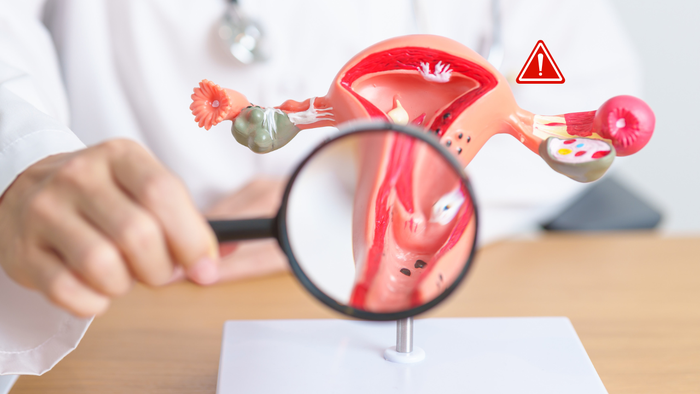 Bé gái 9 tuổi đau bụng kéo dài, bác sĩ phát hiện u buồng trứng lớn 7cm- Ảnh 1.