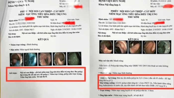 Vaccine ung thư: Hiểu đúng để không kỳ vọng quá mức- Ảnh 1. Vaccine ung thư: Hiểu đúng để không kỳ vọng quá mức- Ảnh 1.