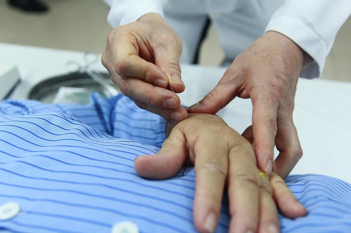 Chữa mất ngủ kinh niên bằng châm cứu- Ảnh 3. Chữa mất ngủ kinh niên bằng châm cứu- Ảnh 3.