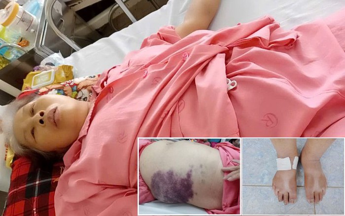 Hết lòng cưu mang "con nuôi", người phụ nữ U70 cuối đời phải đi hầu kiện- Ảnh 2.