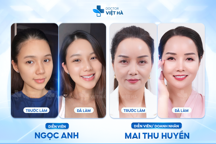 Ánh nhìn của thời đại mới: BIOLID SCULPT 6.0 và dấu ấn tinh tế từ bác sĩ Việt Hà

- Ảnh 3.