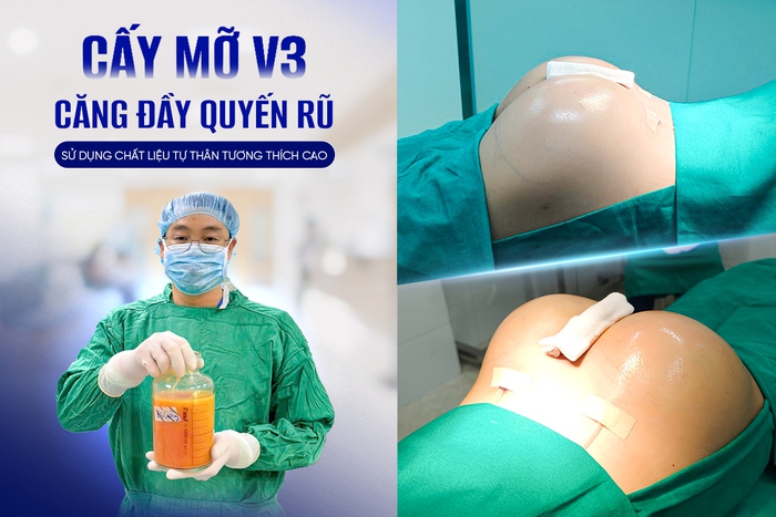 Ths.BS Bùi Văn Cường: Cấy mỡ tự thân - Hành trình đưa vẻ đẹp trở về với tự nhiên- Ảnh 1.