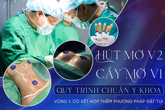 Ths.BS Bùi Văn Cường: Cấy mỡ tự thân - Hành trình đưa vẻ đẹp trở về với tự nhiên- Ảnh 2.