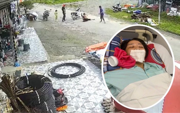 Vụ chó gây tai nạn ở Lào Cai: Công an xã Bảo Hà đã xác minh được chủ chó sau loạt bài phản ánh- Ảnh 1.