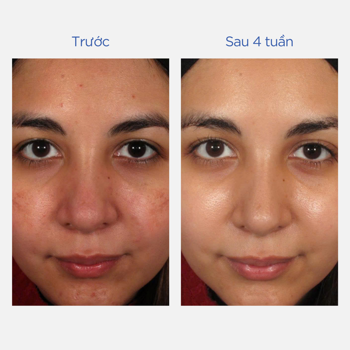 MD Restoring Power-C Serum với bí quyết trẻ hóa làn da sau 12 tuần- Ảnh 2. MD Restoring Power-C Serum với bí quyết trẻ hóa làn da sau 12 tuần- Ảnh 2.