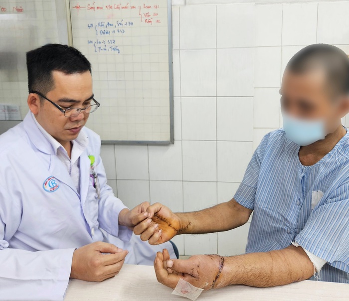 Nối thành công đôi bàn tay của nam thanh niên bị chém đứt lìa - Ảnh 1.