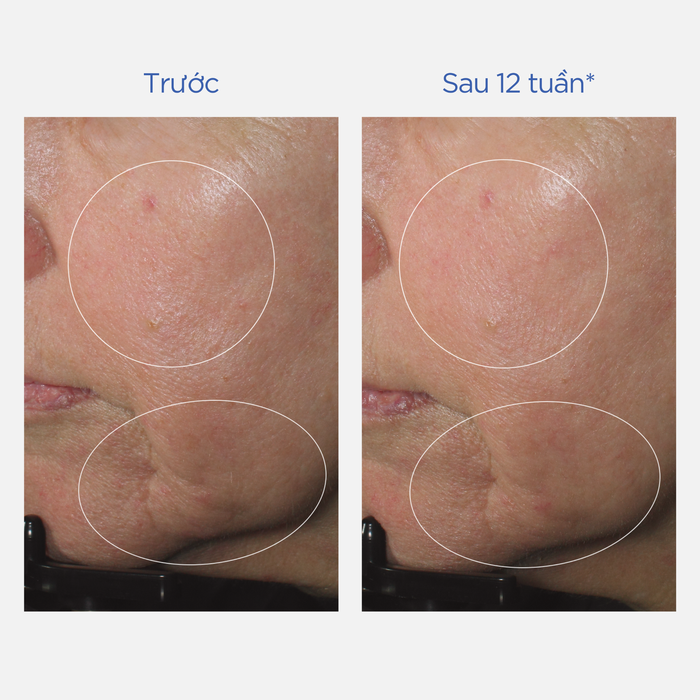 MD Restoring Power-C Serum với bí quyết trẻ hóa làn da sau 12 tuần- Ảnh 4. MD Restoring Power-C Serum với bí quyết trẻ hóa làn da sau 12 tuần- Ảnh 4.