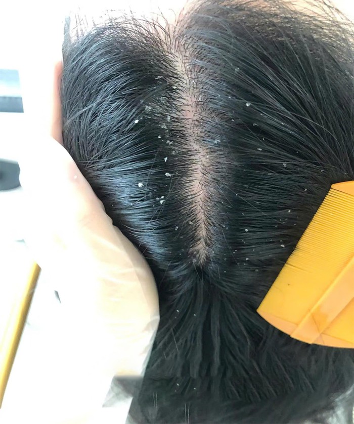 Tóc sạch gàu, không ngứa, không rụng: Bí quyết tự tin của hàng nghìn phụ nữ Việt- Ảnh 1.