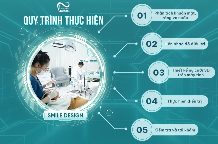 Thiết kế nụ cười độc bản bằng công nghệ Smile Design tại Nha khoa Thiên Hà- Ảnh 2.