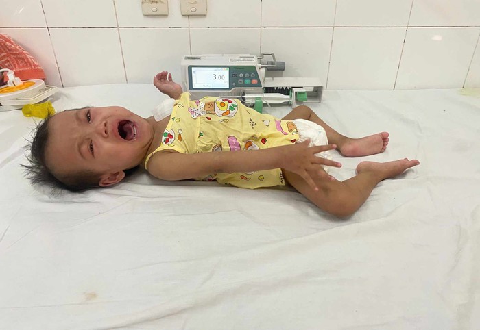 Mẹ nghèo xin sữa để cầm chừng sự sống cho con gái 3 tuổi mắc bệnh quái ác- Ảnh 1.